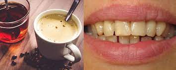 Cà phê có làm ố răng của bạn không?